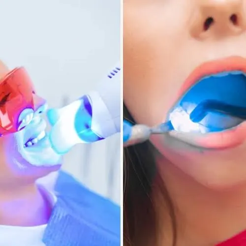 Importance of Laser Dentistry Importance of Laser Dentistry