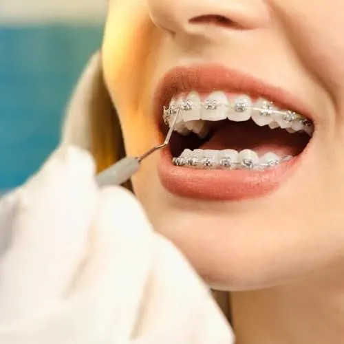 Importance of Orthodontics in Dentistry Importance of Orthodontics in Dentistry