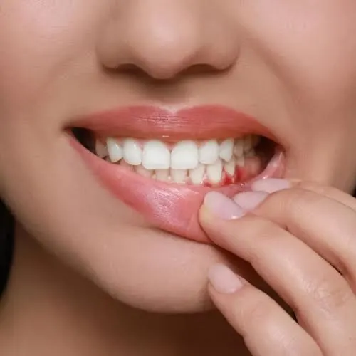 Importance of Periodontics in Dentistry Importance of Periodontics in Dentistry