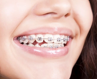 Root canal treatment in dwarka Root canal treatment in dwarka