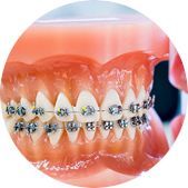 Orthodontic Treatment In Dwarka